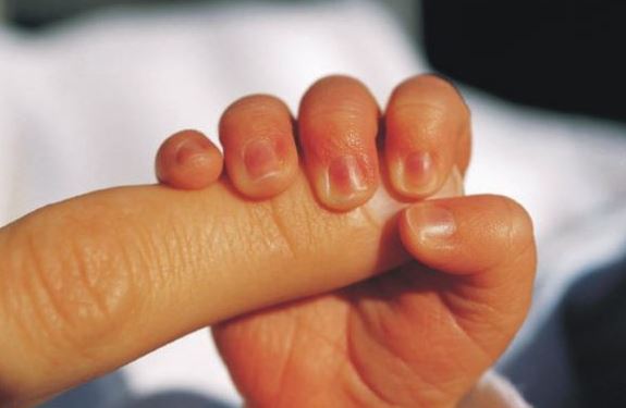 Una izquierda obsesionada «sólo» con el aborto