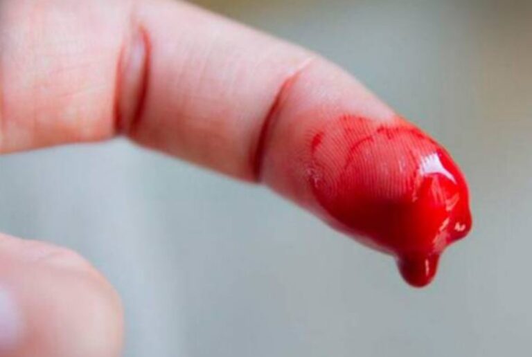 Post «kakuna»: ¿escuchaste hablar de hemofilia últimamente?